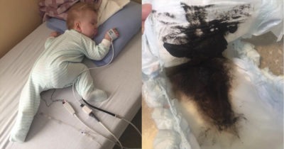 Мать дала малышке жаропонижающее, вскоре пришлось вызывать скорую помощь